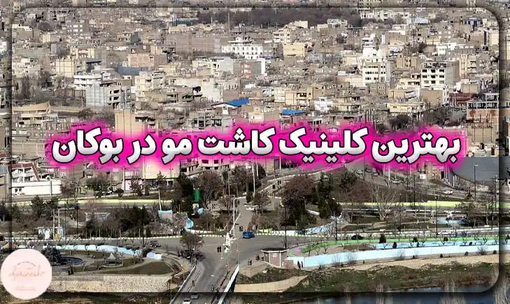 بهترین کلینیک کاشت مو در بوکان