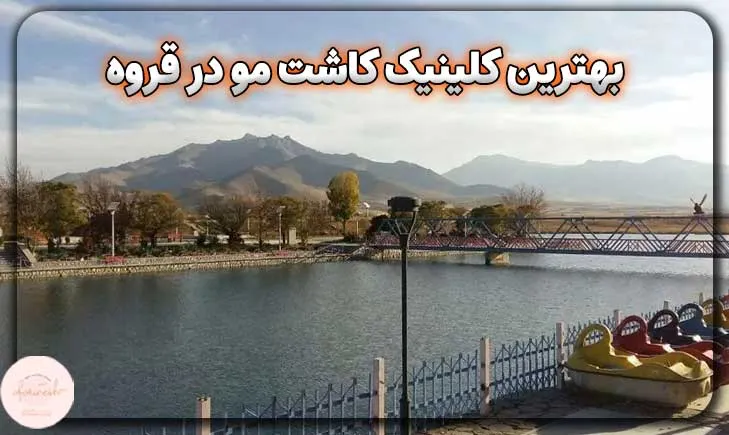 بهترین کلینیک کاشت مو در قروه