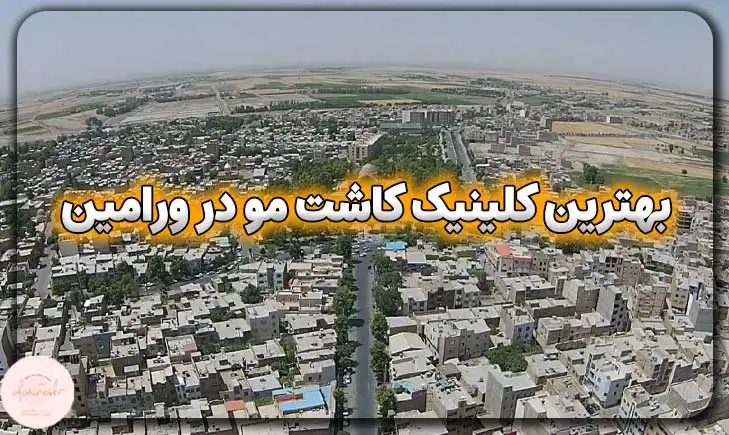 بهترین کلینیک کاشت مو در ورامین
