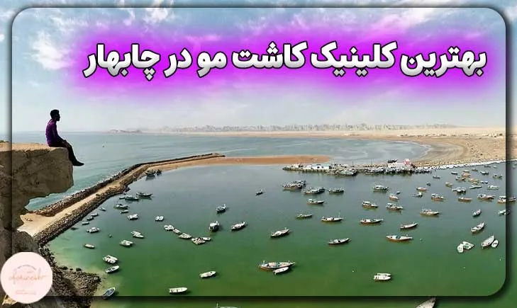 بهترین کلینیک کاشت مو در چابهار