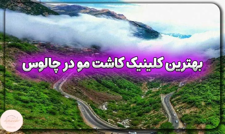 بهترین کلینیک کاشت مو در چالوس
