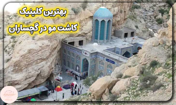 بهترین کلینیک کاشت مو در گچساران