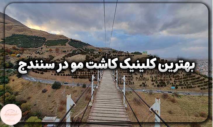 بهترین کلینیک کاشت مو در سنندج