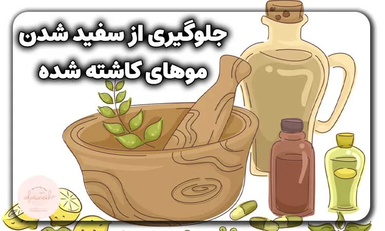 جلوگیری از سفید شدن موهای کاشته شده