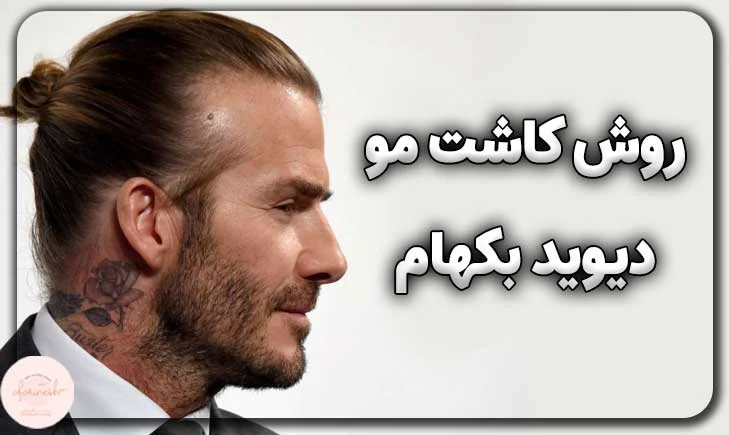 روش کاشت مو دیوید بکهام