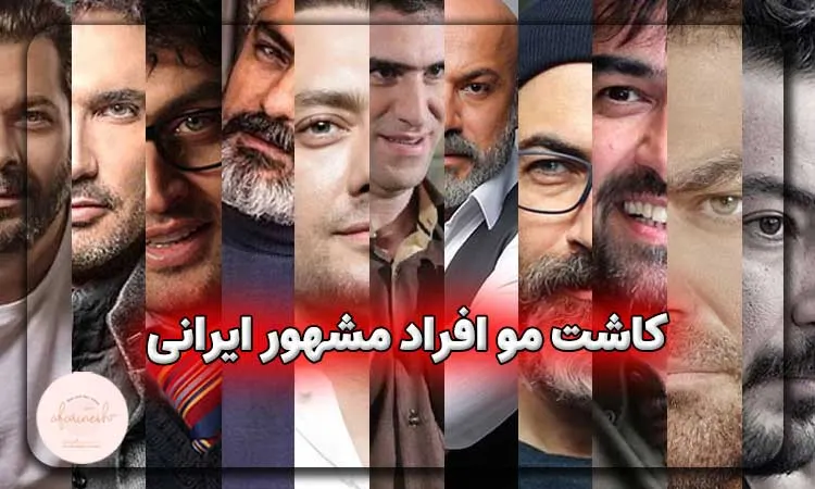 کاشت مو افراد مشهور ایرانی