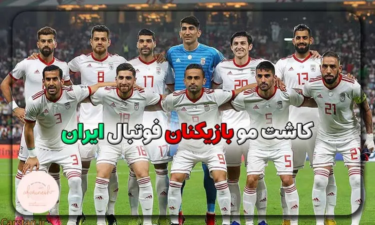 کاشت مو بازیکنان فوتبال ایران