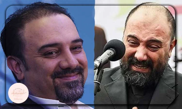 کاشت مو برزو ارجمند