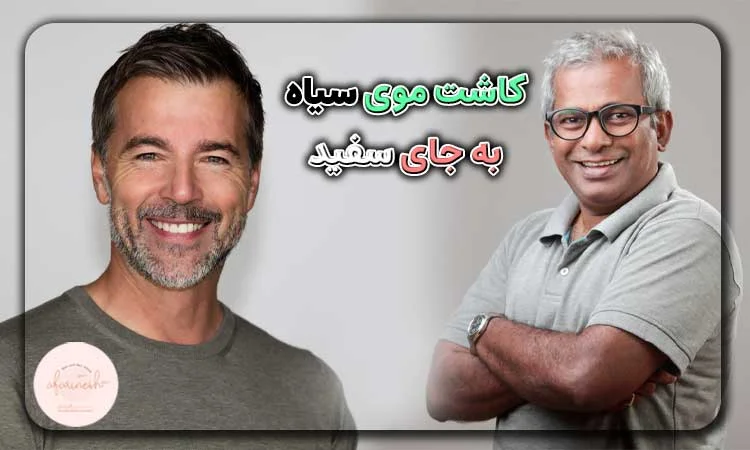 کاشت موی سیاه به جای سفید