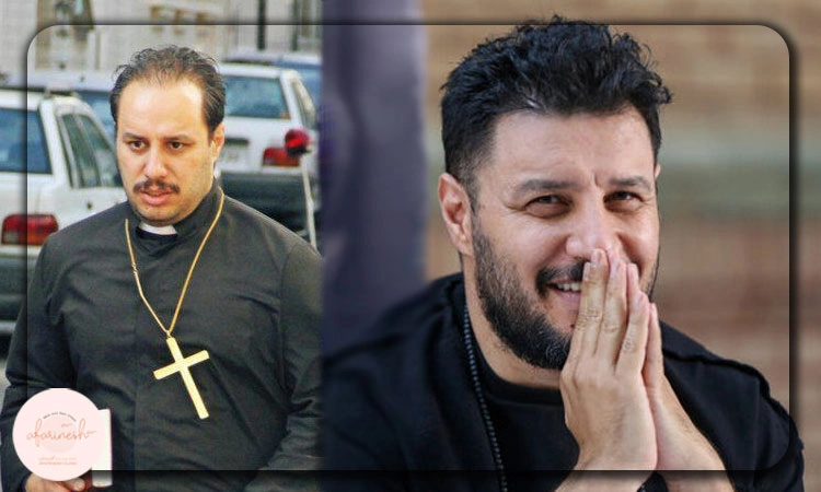 قبل و بعد از کاشت مو جواد عزتی