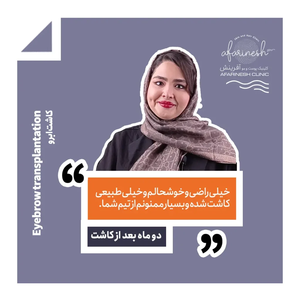 نظرات کسانی که کاشت ابرو انجام داده اند