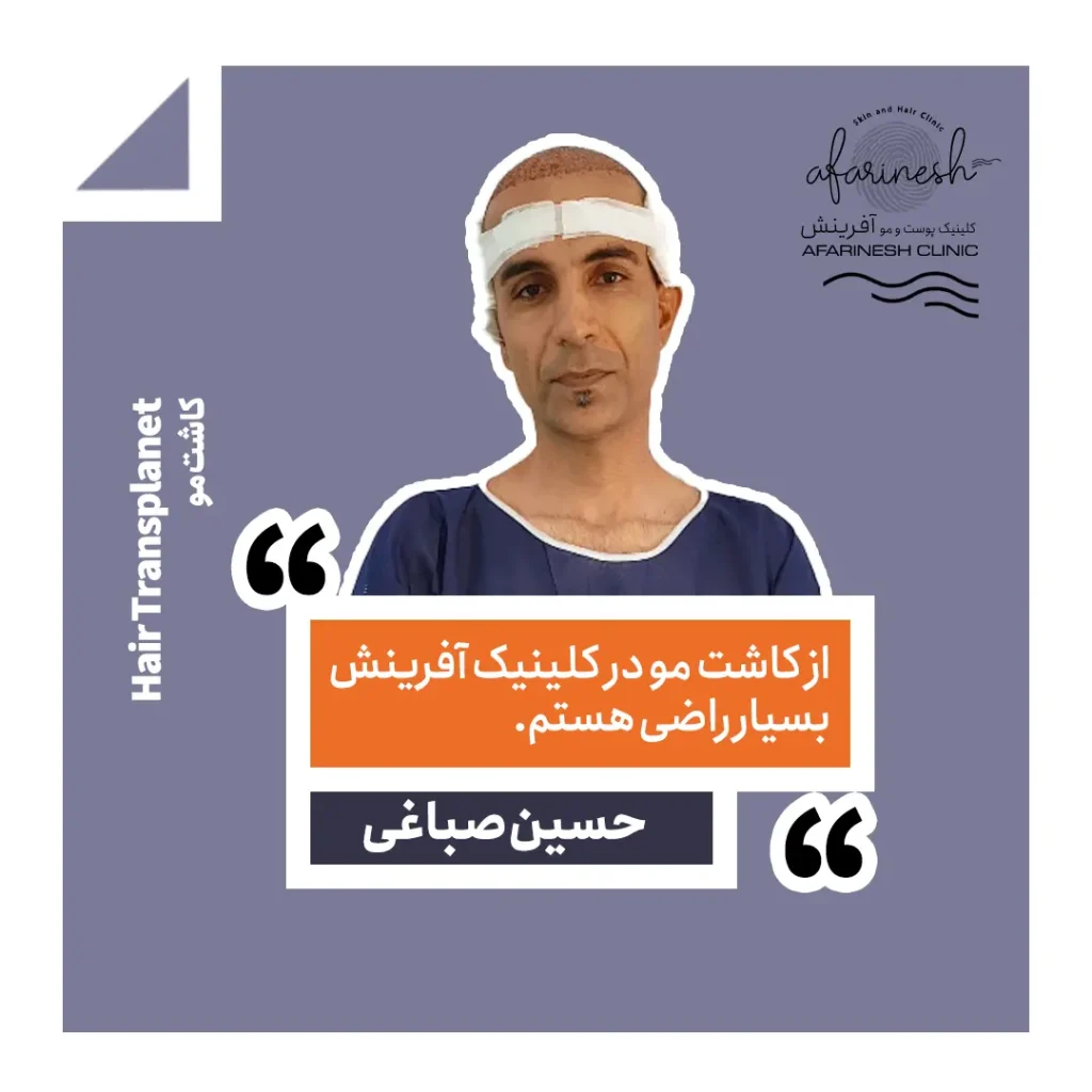 نظرات کسانی که در کلینیک آفرینش کاشت مو انجام داده اند
