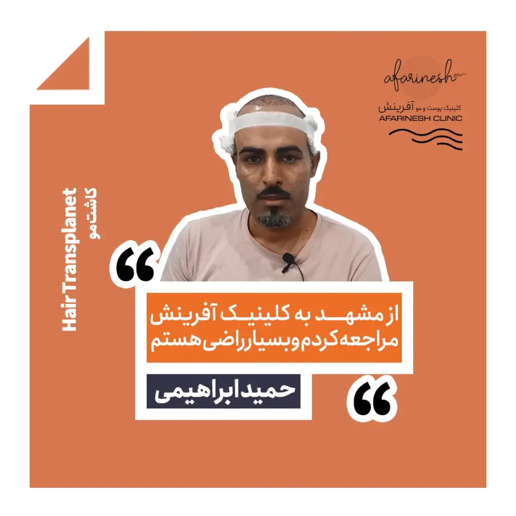 نظرات کسانی که در کلینیک آفرینش کاشت مو انجام داده اند