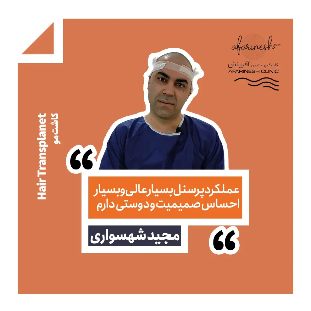 نظرات کسانی که در کلینیک آفرینش کاشت مو انجام داده اند