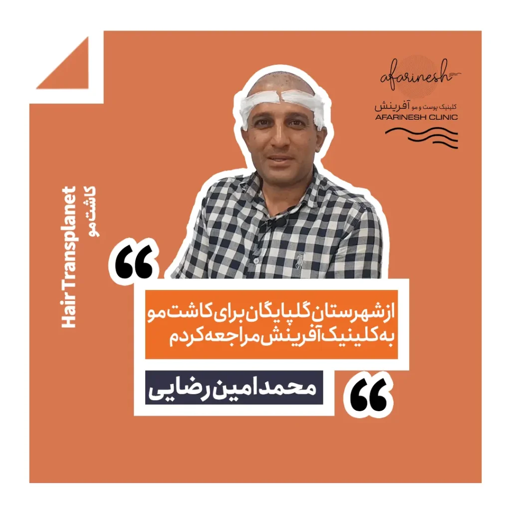 نظرات کسانی که در کلینیک آفرینش کاشت مو انجام داده اند