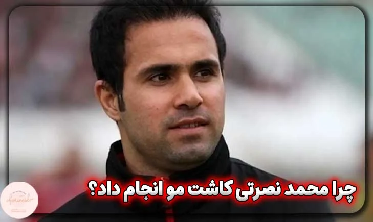 چرا محمد نصرتی کاشت مو انجام داد؟