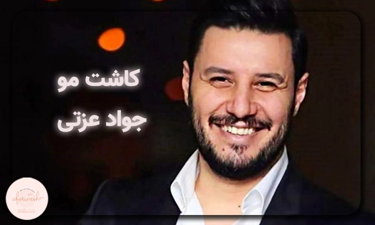 کاشت مو جواد عزتی