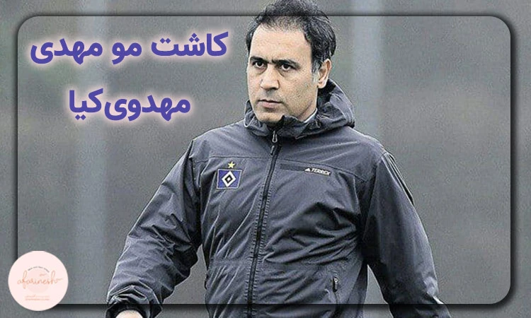 کاشت مو مهدی مهدویکیا