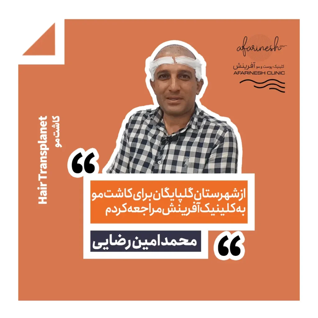 نظرات کسانی که در کلینیک آفرینش کاشت مو انجام داده اند