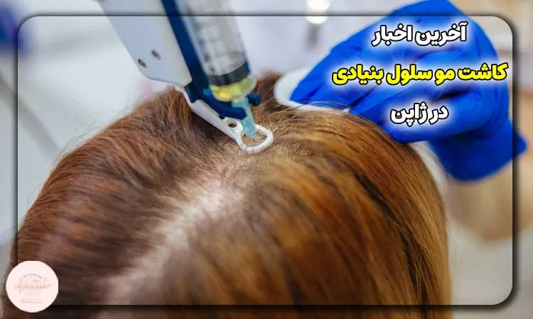 آخرین اخبار کاشت مو سلول بنیادی در ژاپن