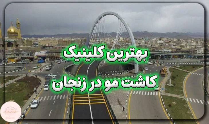 بهترین کلینیک کاشت مو در زنجان