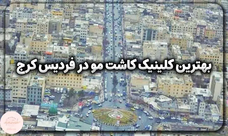 بهترین کلینیک کاشت مو در فردیس کرج