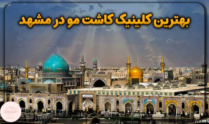 بهترین کلینیک کاشت مو در مشهد
