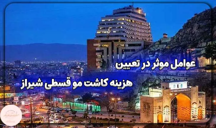 عوامل موثر در تعیین هزینه کاشت مو قسطی شیراز