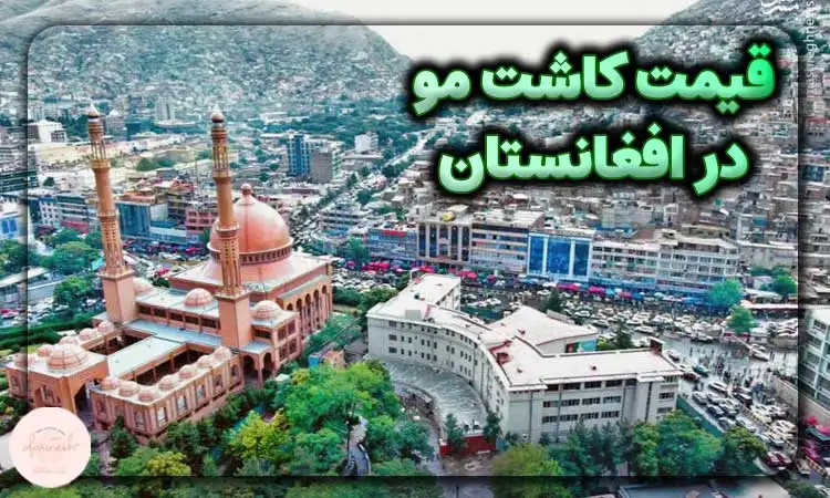 قیمت کاشت مو در افغانستان