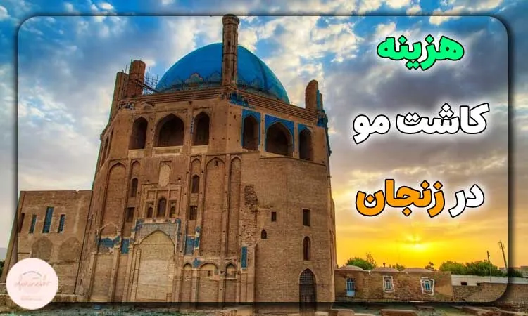 هزینه کاشت مو در زنجان