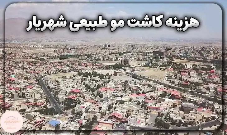هزینه کاشت مو طبیعی شهریار