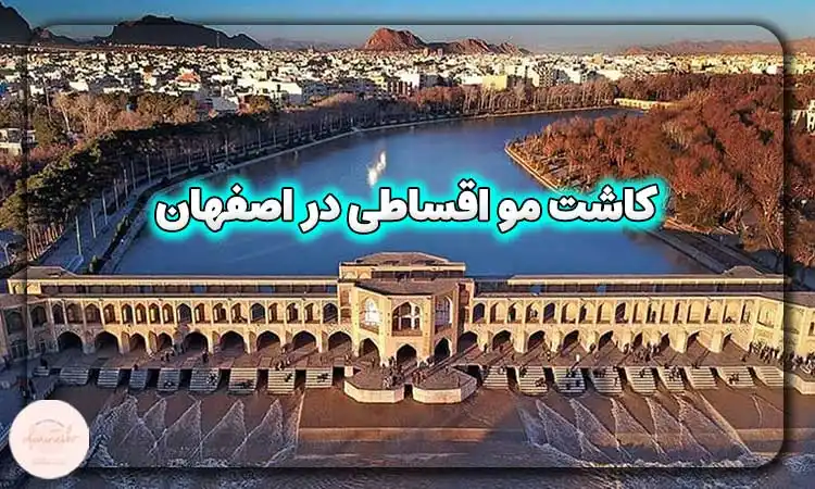 کاشت مو اقساطی در اصفهان