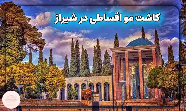 کاشت مو اقساطی در شیراز