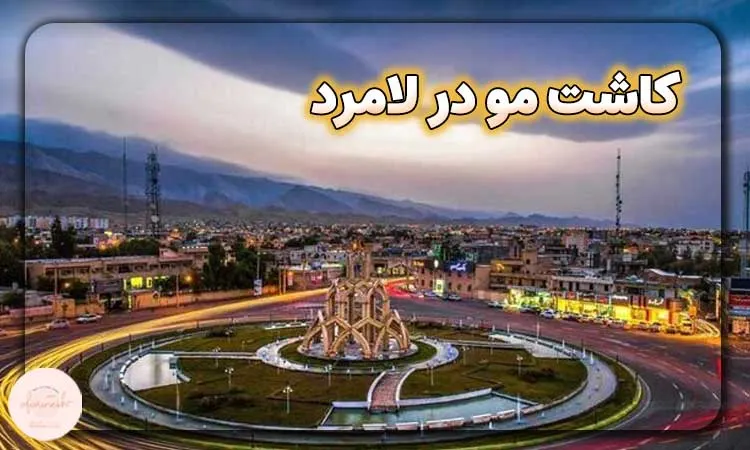 کاشت مو در لامرد