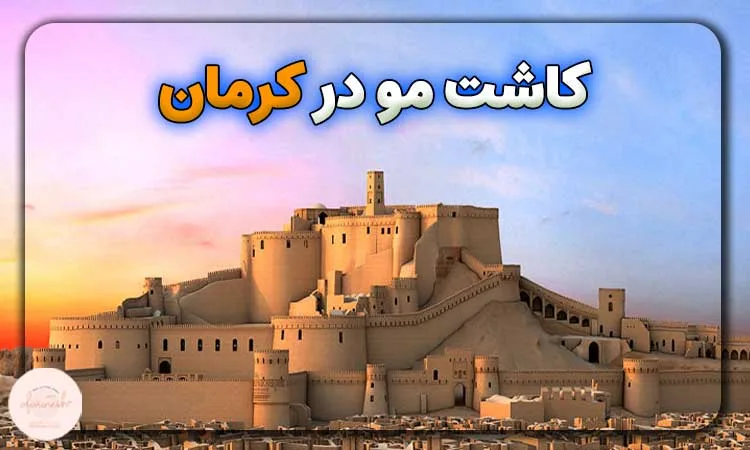 کاشت مو در کرمان