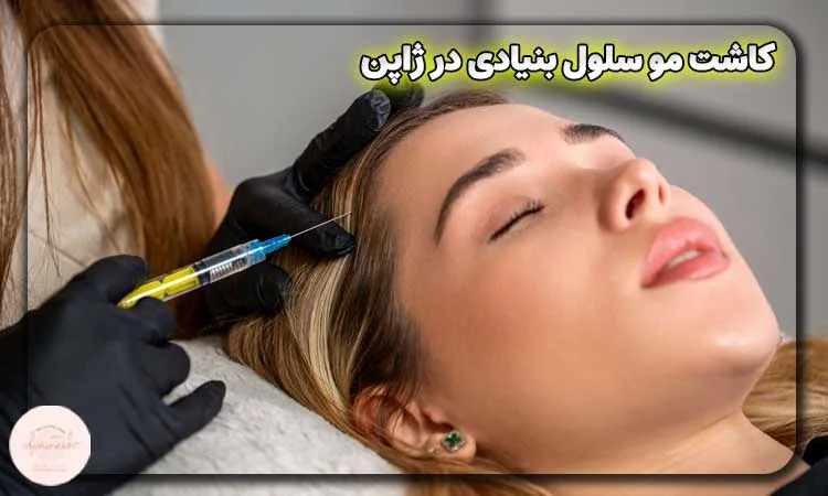 کاشت مو سلول بنیادی در ژاپن