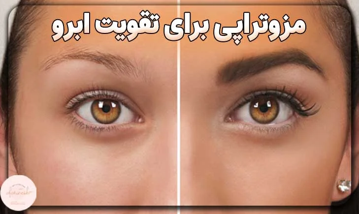 آیا مزوتراپی ابرو باعث تقویت ابرو می شود