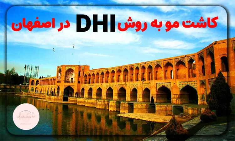کاشت مو به روش DHI در اصفهان