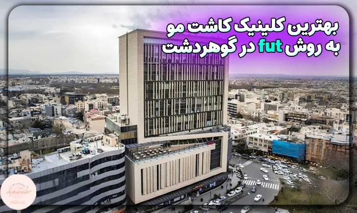 بهترین کلینیک کاشت مو به روش fut در گوهردشت