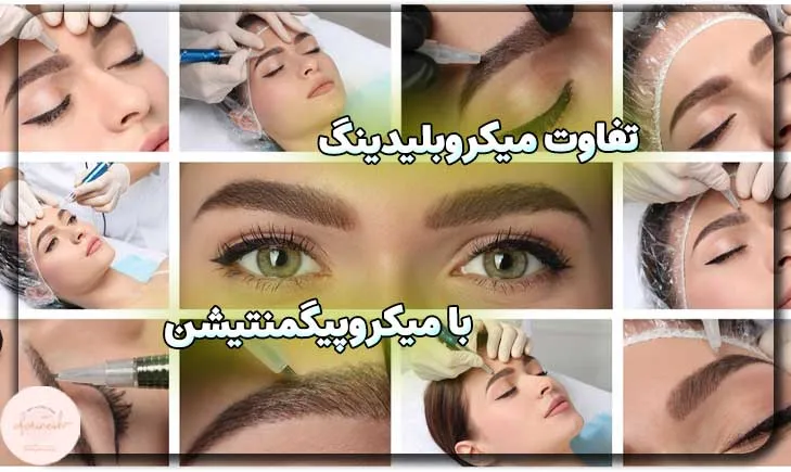 تفاوت میکروبلیدینگ و میکروپیگمنتیشن