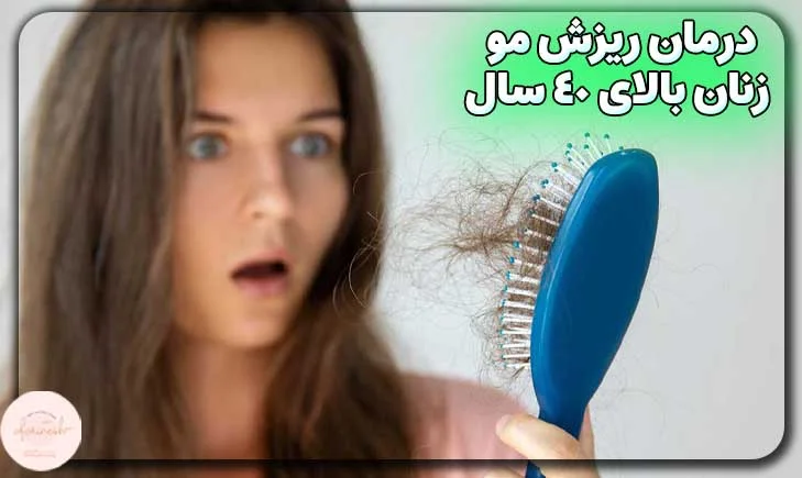 روش های درمان ریزش مو در زنان بالای 40 سال