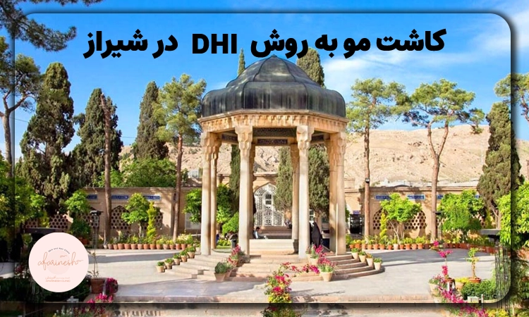 کاشت مو به روش DHI در شیراز