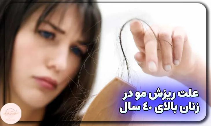 علت ریزش مو در زنان بالای 40 سال