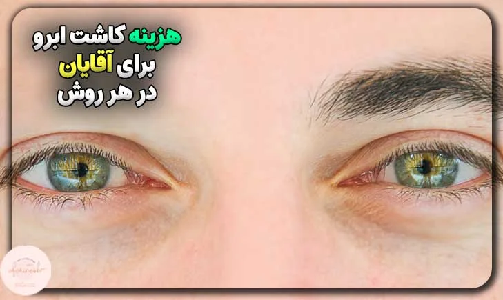 هزینه کاشت ابرو برای آقایان در هر روش