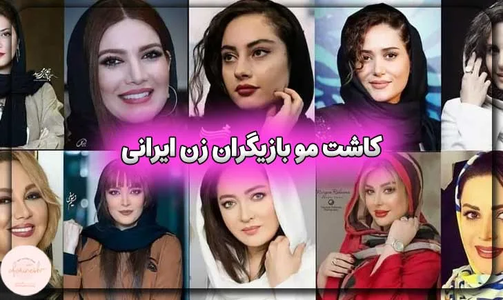 کاشت مو بازیگران زن ایرانی