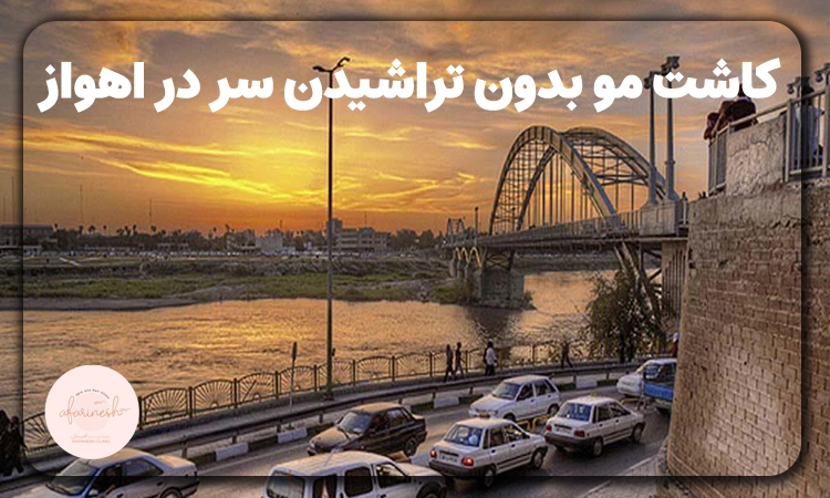 کاشت مو بدون تراشیدن سر در اهواز