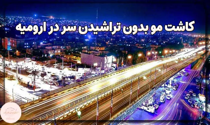 کاشت مو بدون تراشیدن سر در ارومیه