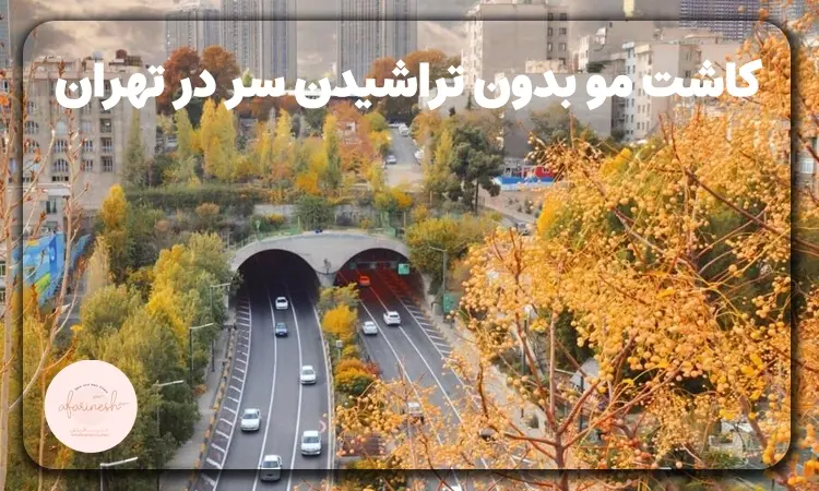 کاشت مو بدون تراشیدن سر در تهران