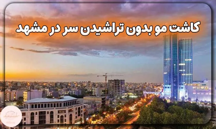 کاشت مو بدون تراشیدن سر در مشهد