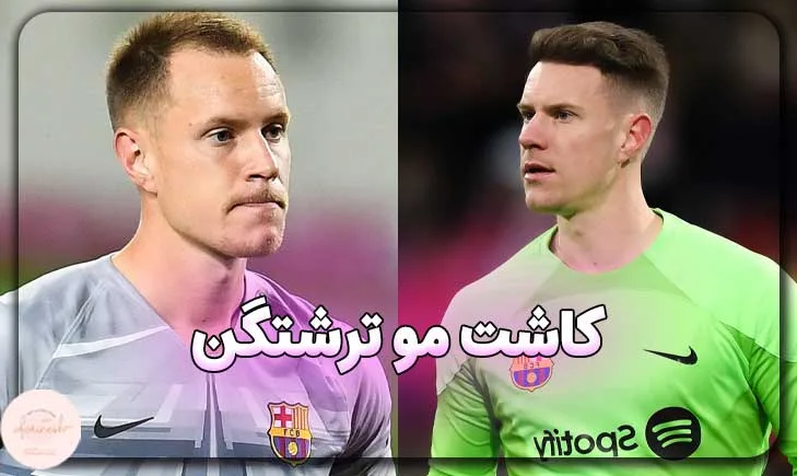 کاشت مو ترشتگن